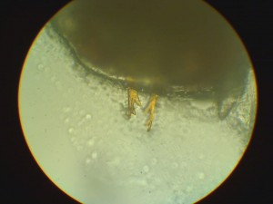 Horns on a tiny insect's head magnified 640x